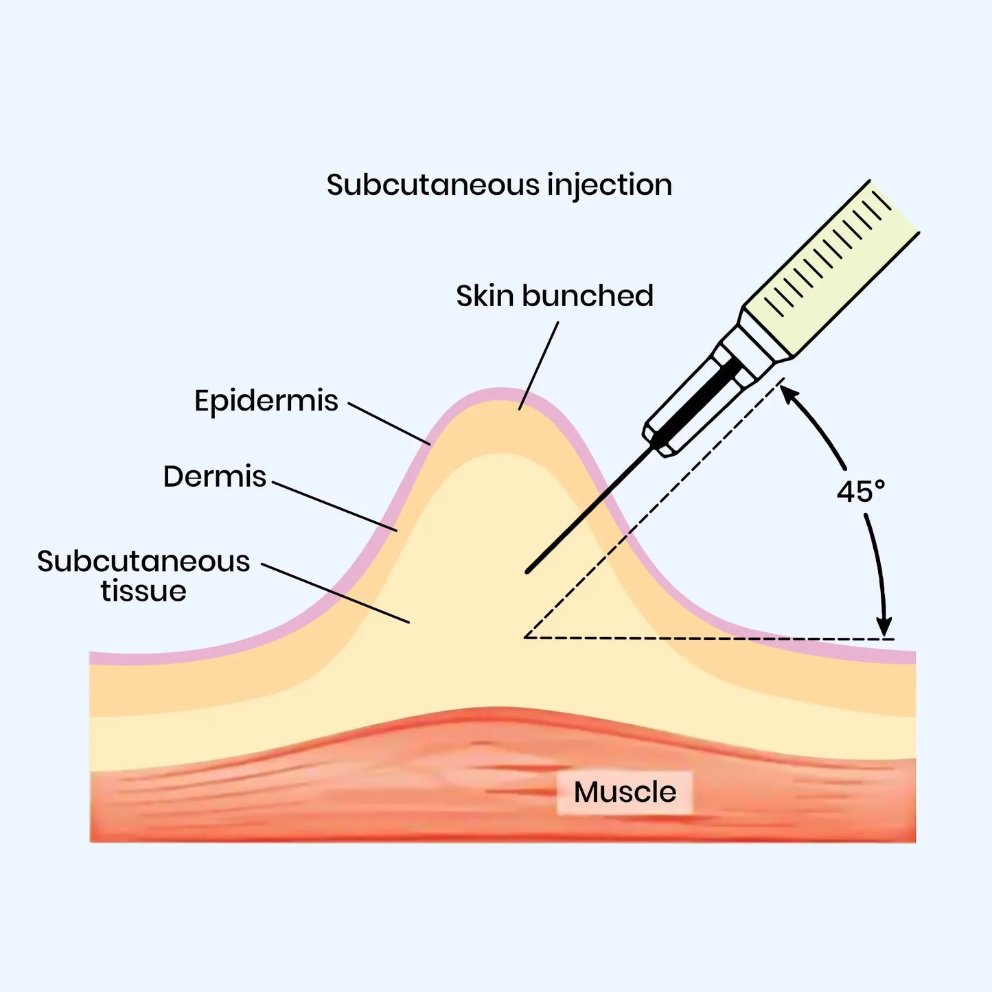 FIP Treatment Injection
